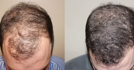 hair loss doctor New Jersey