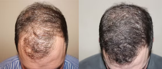 hair loss doctor New Jersey