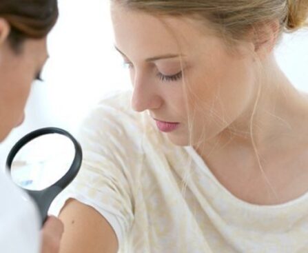 botox treatment Huntington Beach CA